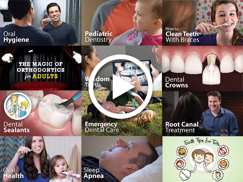 Dental Videos