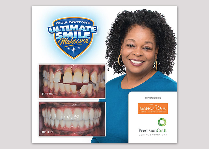 Celeste Ultimate Smile Makeover
