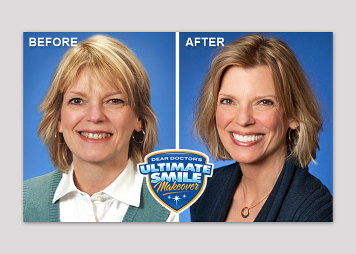 Lorna Ultimate Smile Makeover