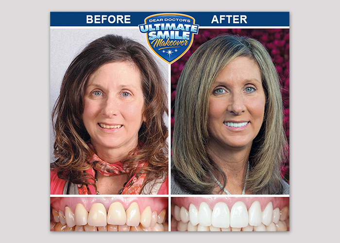 Sue Ultimate Smile Makeover