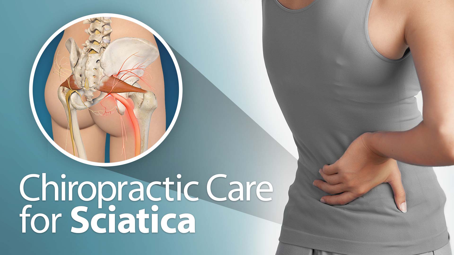 Sciatica